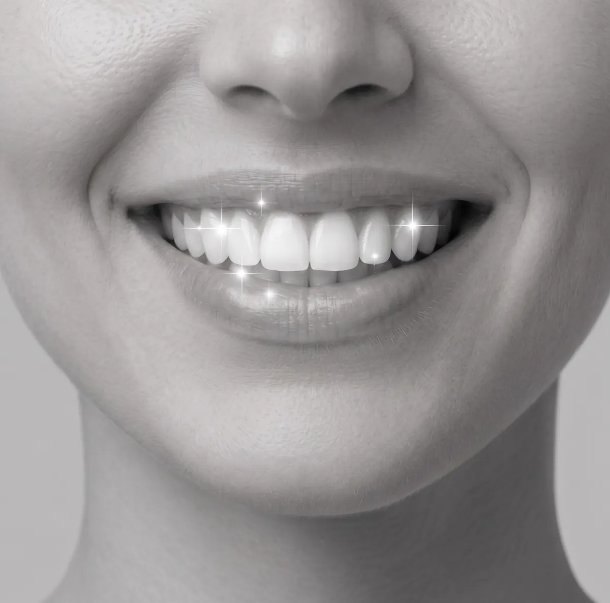 Blanqueamiento dental en Bioestética Dental