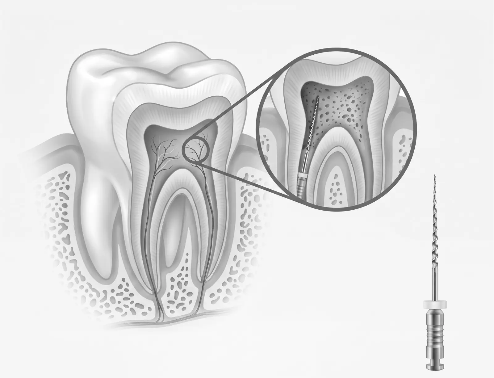 Endodoncia en Bioestética Dental